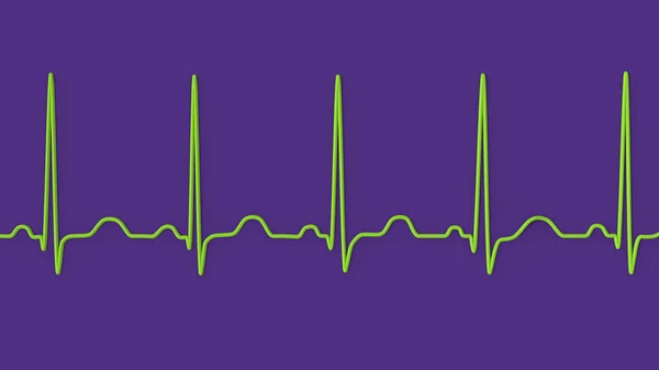 Детальна Ілюстрація Електрокардіограми Ecg Показує Синусову Тахікардію Звичайний Серцевий Ритм — стокове фото