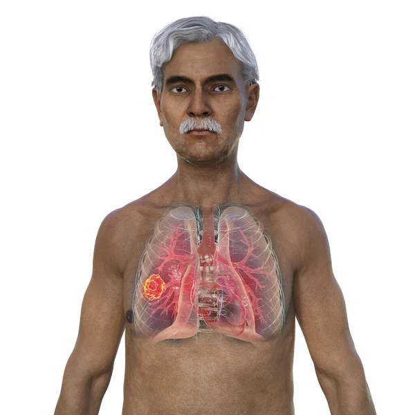 Photorealistic Illustration Upper Half Part Man Transparent Skin Revealing Lung — Stock Photo, Image