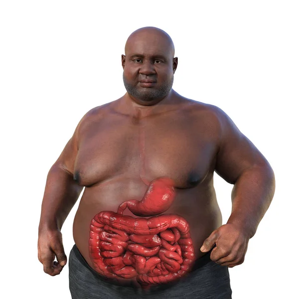 Μια Λεπτομερής Τρισδιάστατη Ιατρική Απεικόνιση Ενός Υπέρβαρου Άνδρα Διαφανές Δέρμα — Φωτογραφία Αρχείου