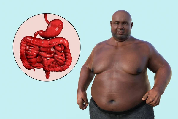 Illustration Médicale Détaillée Homme Surpoids Peau Transparente Révélant Système Digestif — Photo
