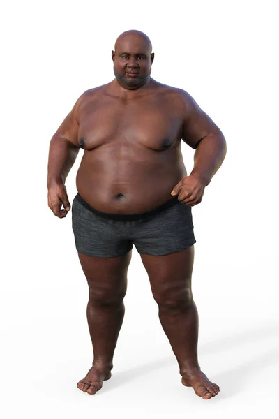 一个全面的3D医学说明描述了一个体重超标的非洲男人的全身形象 强调了超重的生理影响 — 图库照片