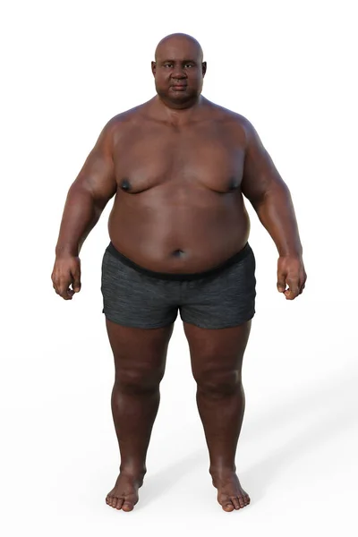 Aşırı Kilolu Bir Afrikalı Nın Vücut Kompozisyonu Ile Tüm Vücudu — Stok fotoğraf