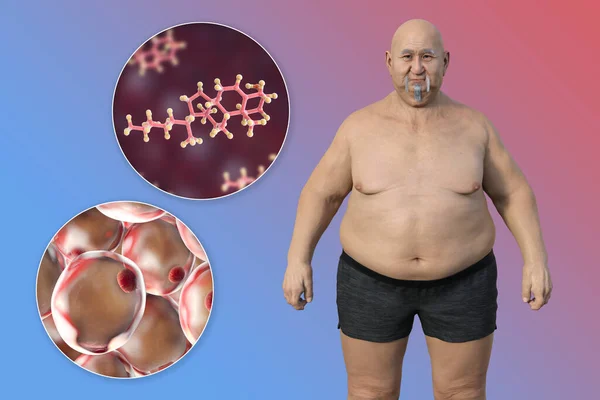 Ilustracja Medyczna Nadwagą Człowieka Bliskim Widokiem Adipocyty Cząsteczki Cholesterolu Podkreślająca — Zdjęcie stockowe