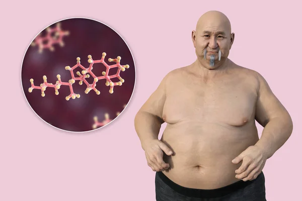 Медична Ілюстрація Зображенням Надлишкової Ваги Людини Крупним Планом Молекули Холестерину — стокове фото