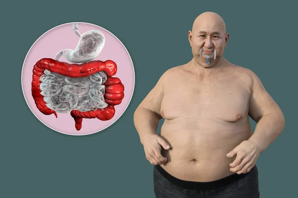 Homme Surpoids Une Vue Rapprochée Son Système Digestif Mettant Évidence — Photo