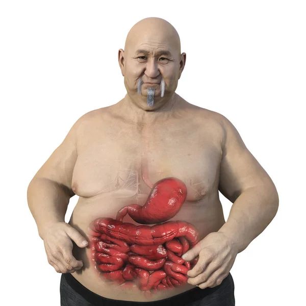 Részletes Orvosi Illusztráció Egy Túlsúlyos Átlátszó Bőrű Férfiról Feltárva Emésztőrendszert — Stock Fotó