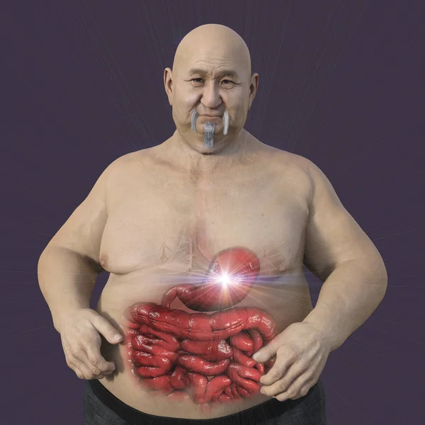 Детальна Медична Ілюстрація Надмірної Ваги Людини Прозорою Шкірою Розкриває Травну — стокове фото