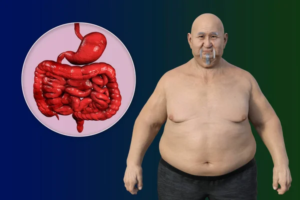 Illustration Médicale Détaillée Homme Surpoids Peau Transparente Révélant Système Digestif — Photo