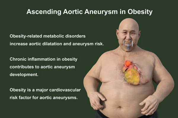 Scientific Illustration Depicting Obese Man Transparent Skin Revealing Ascending Aortic — Stock Photo, Image