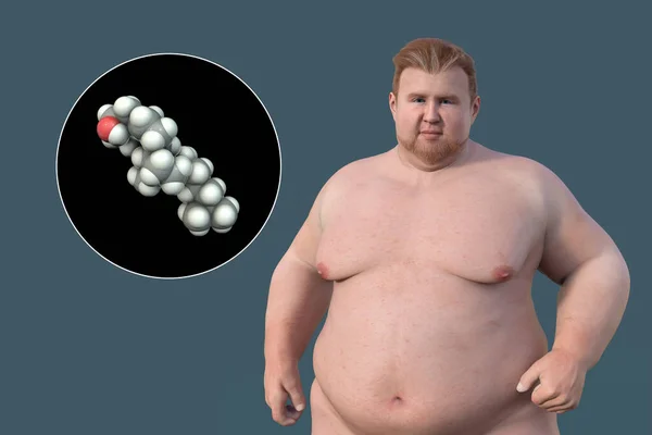 Ilustracja Medyczna Nadwagą Człowieka Bliskim Widokiem Cząsteczkę Cholesterolu Podkreślająca Związek — Zdjęcie stockowe