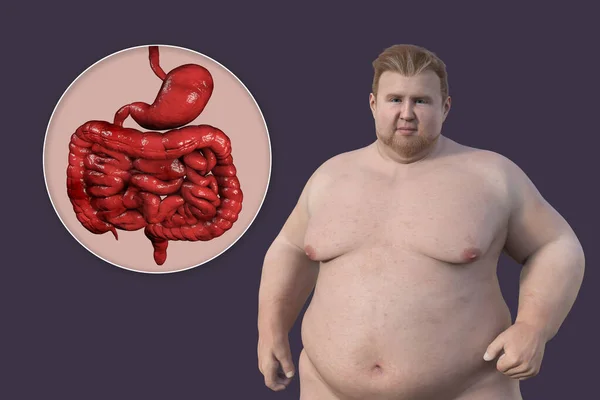 Detailed Medical Illustration Overweight Man Transparent Skin Revealing Digestive System — Stock Photo, Image