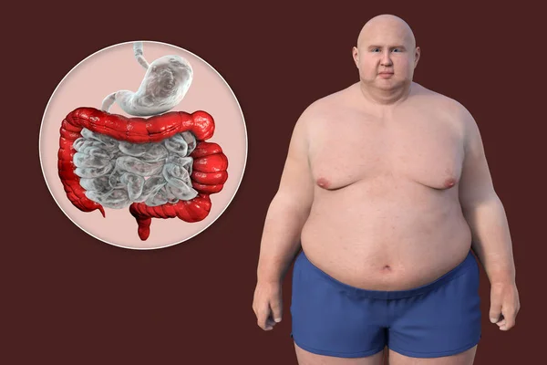 Een Man Met Overgewicht Close Zicht Zijn Spijsverteringsstelsel Met Nadruk — Stockfoto