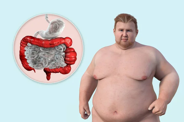 Een Man Met Overgewicht Close Zicht Zijn Spijsverteringsstelsel Met Nadruk — Stockfoto