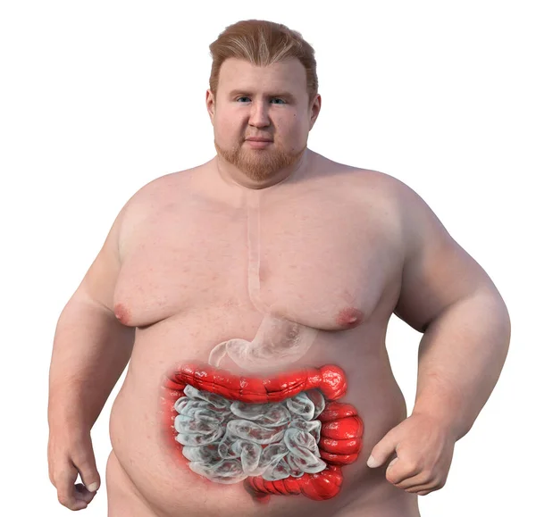 Hombre Con Sobrepeso Piel Transparente Mostrando Sistema Digestivo Destacando Presencia — Foto de Stock
