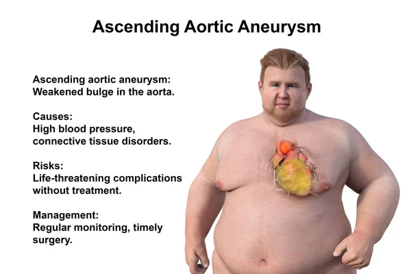 Scientific Illustration Depicting Obese Man Transparent Skin Revealing Ascending Aortic — Stock Photo, Image