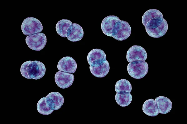 폐렴을 호흡기 감염을 일으키는 원인이 Spretococcus Pneumoniae 박테리아 Pneumococcus Gram — 스톡 사진