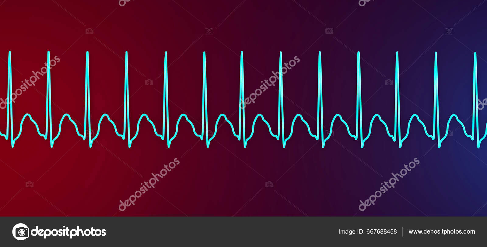 Tachycardia: Fast Heart Rate