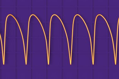 Ventriküler taşikardi: hızlı kalp ritmi kalp çarpıntısına, baş dönmesine, hayati tehlikesi olan semptomlara neden olur. ECG geniş QRS kompleksleri, 3 boyutlu illüstrasyon gösteriyor.