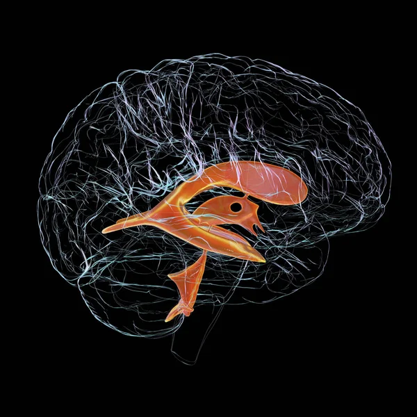 Ventricular system of brain, side view, 3D illustration. The ventricles are cavities in the brain that are filled with cerebrospinal fluid, CSF.