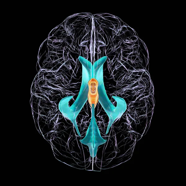 Illustrazione Scientifica Raffigurante Allargamento Isolato Del Terzo Ventricolo Cerebrale Vista — Foto Stock