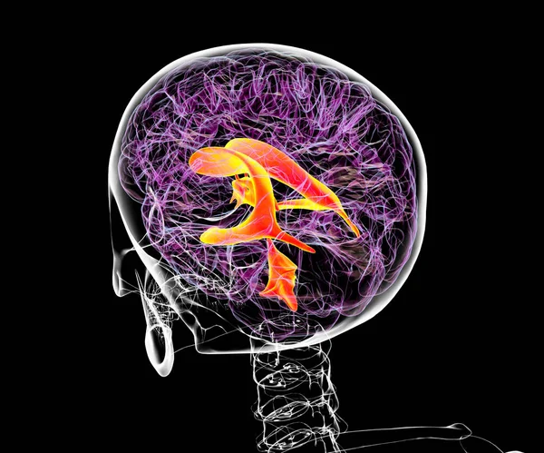 Ventrikulärt System Hjärnan Illustration Kamrarna Håligheter Hjärnan Som Fyllda Med — Stockfoto