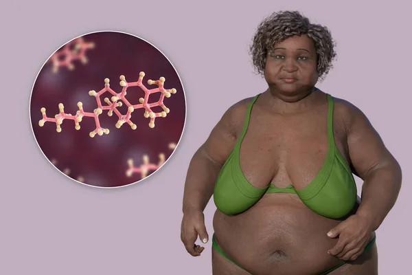 这是一个3D医学说明 描述了一个超重女性与胆固醇分子的近距离接触 强调肥胖与胆固醇代谢变化之间的联系 — 图库照片