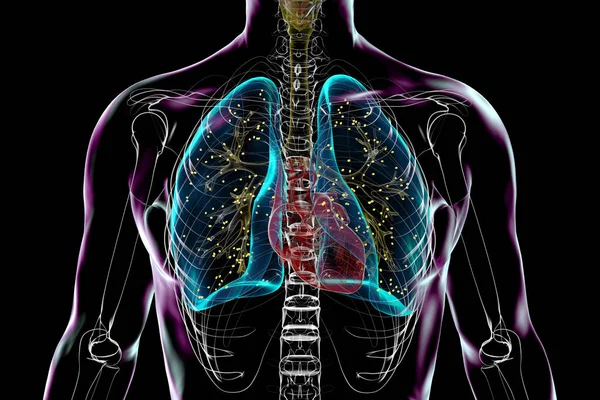 Adiaspiromicosis Pulmonar Una Rara Infección Respiratoria Causada Por Hongo Emmonsia —  Fotos de Stock