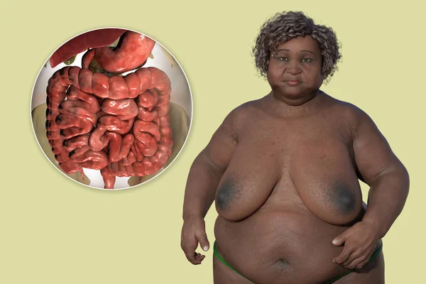 Una Mujer Con Sobrepeso Vista Cerca Del Sistema Digestivo Ilustración — Foto de Stock