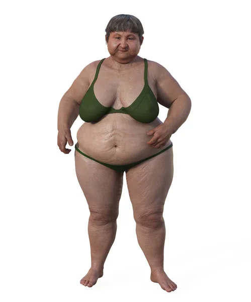 一个体重超标的女人 3D医学图解凸显了超重对生理的影响 — 图库照片