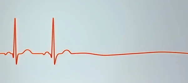 アシストールは 心臓の電気活動がないことを示す重要な状態です 3Dイラストは 脈拍や鼓動のない機能しない心臓を意味するEcgのフラットラインを示しています — ストック写真