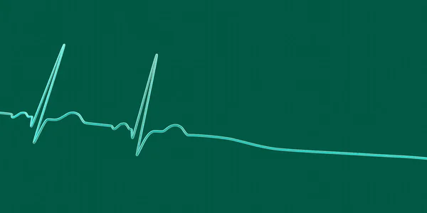 收缩期 一种以没有任何心脏电活动为特征的严重状况 3D插图显示心电图上的一条扁平线 表示心脏不能正常运作 没有脉搏或心跳 — 图库照片