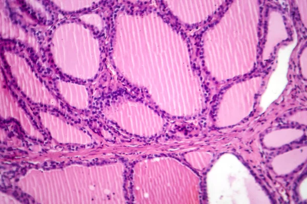 Fotomikrograf Toksycznej Próbki Tkanki Koziej Pod Mikroskopem Ujawniający Przerost Komórek — Zdjęcie stockowe