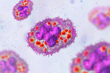 Makrofaj hücresindeki Histoplazma kapsülü mayaları, 3 boyutlu illüstrasyon. Histoplazma, akciğer enfeksiyonuna yol açabilen, maya benzeri dimorfik bir mantar türüdür..