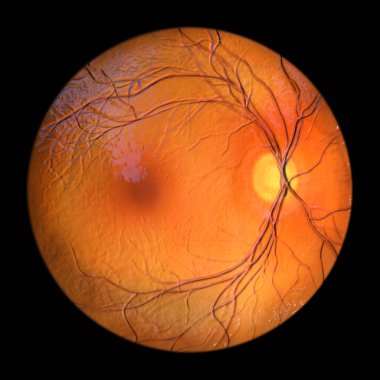 Optalmoskopi sırasında gözlemlendiği gibi sağlıklı, normal bir retinayı gösteren üç boyutlu bir medikal illüstrasyon net retinal yapılar ve vaskülasyon gösteriyor..