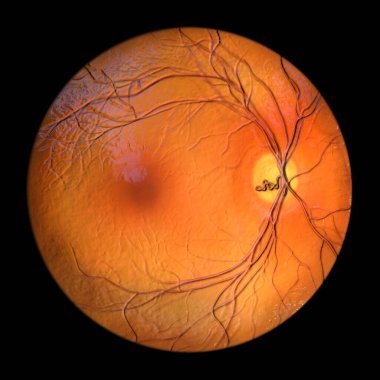 Göz muayenesinde gözlemlendiği üzere retinadaki prepapiller vasküler döngü, optik diskin etrafındaki kan damarlarını gösteren üç boyutlu illüstrasyon.