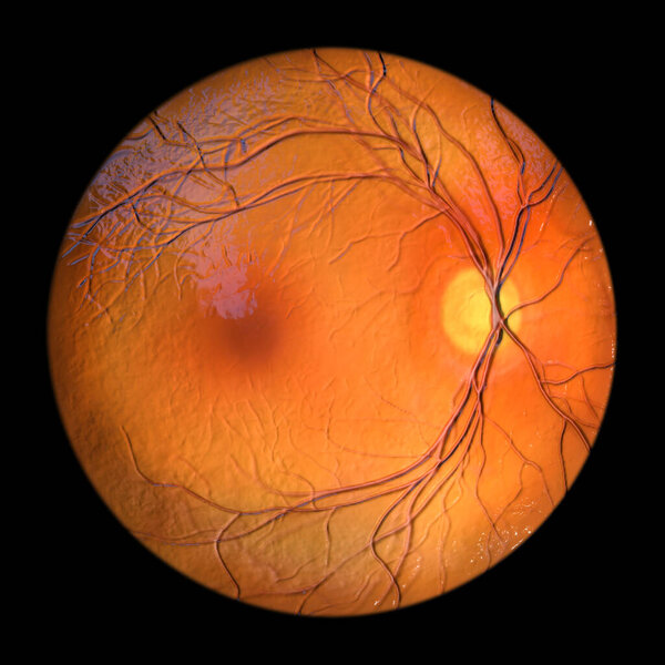 A medical 3D illustration showcasing a healthy, normal retina as observed during ophthalmoscopy, displaying clear retinal structures and vasculature.