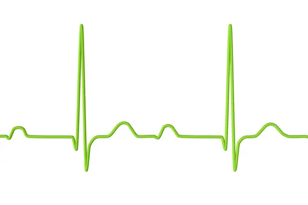Ilustração Ecg Exibindo Bloqueio Primeiro Grau Distúrbio Condução Cardíaca — Fotografia de Stock