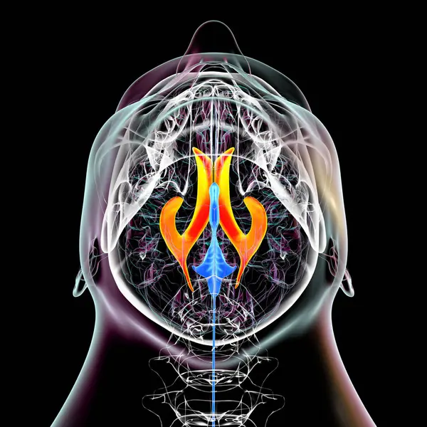 Los Ventrículos Cerebrales Laterales Las Cavidades Emparejadas Más Grandes Cerebro —  Fotos de Stock