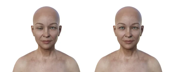 視力低下症の女性 下向きの視力不整合を示す3Dイラスト — ストック写真