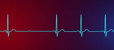 3D illüstrasyon, kalp ritmindeki anormal elektriksel iletimi vurgulayan, 2. derece AV bloğu (Mobitz 2) ile bir ECG görselleştirme.