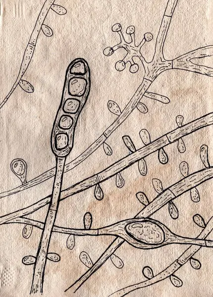 Handgezeichnete Illustration Von Trichophyton Tonsurans Pilzen Auf Gealtertem Papier Die — Stockfoto