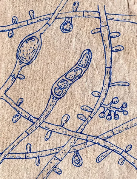 年代久远的纸上手工绘制的特鲁弗赫顿扁桃体真菌的图解 让人想起中世纪的医学绘画 将艺术与真菌学描述相结合 一种引起头皮感染的真菌 — 图库照片