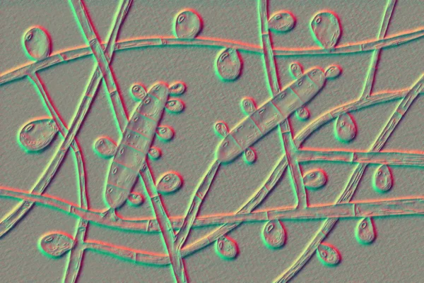 Fungo Trichophyton Rubrum Ilustração Mostrando Macroconídio Microconídios Hifas Septadas Infecta — Fotografia de Stock