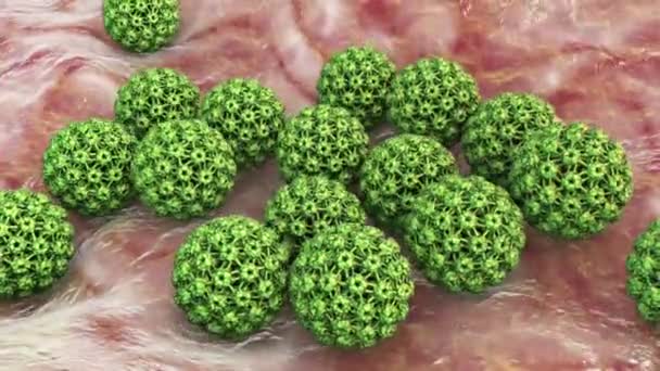 Menselijk Papillomavirus Een Virus Dat Wratten Veroorzaakt Sommige Stammen Infecteren — Stockvideo