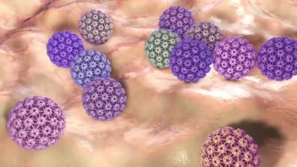 Virus Del Papiloma Humano Virus Que Causa Verrugas Ubicadas Principalmente — Vídeo de stock