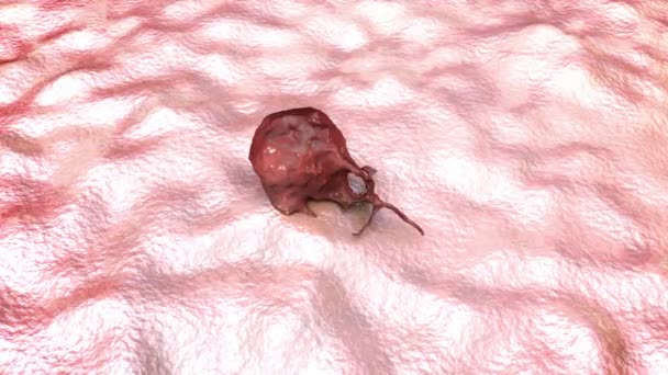 Krebswachstum Animation Die Das Tumorwachstum Und Die Ausbreitung Umgebendes Gewebe — Stockvideo