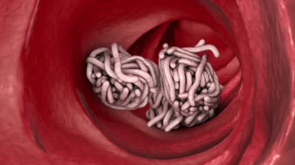 Parasitic Worms Lumen Intestine Animation — Stock Video
