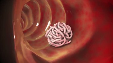 Bağırsaklarda parazit solucanlar, 3 boyutlu animasyon. İnsan bağırsağını istila eden nematode solucanlarının büyümesi ve çoğalması