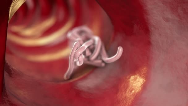 Parasitäre Würmer Lumen Des Lumen Animation Wachstum Und Vermehrung Von — Stockvideo