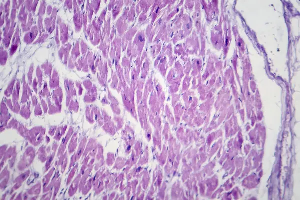 Photomicrograph Cardiac Hypertrophy Showing Enlarged Thickened Cardiac Muscle Fibers Microscope — Stock Photo, Image